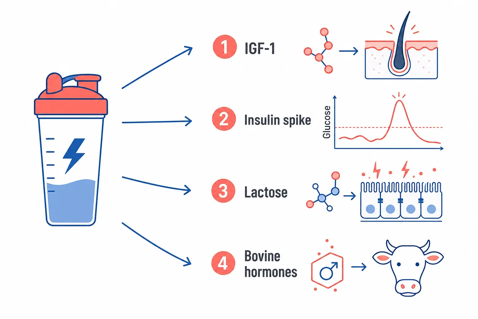 Schéma des 4 mécanismes liant la whey à l'acné : stimulation IGF-1, pic d'insuline, lactose et hormones bovines résiduelles